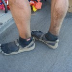 More Repulsive Than Crocs! More Repulsive Than Crocs!